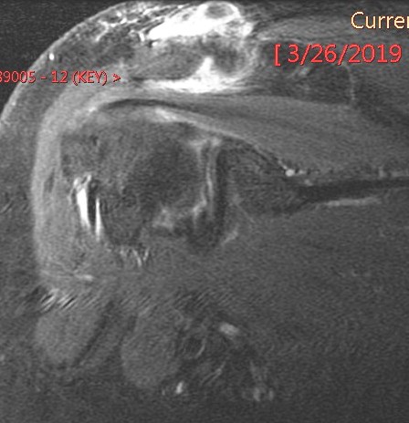 Figure 2 for case Gout ( RID3567 )